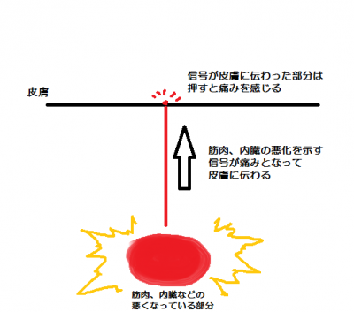 皮内針が効く理由