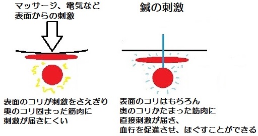 鍼の刺激は奥まで届く
